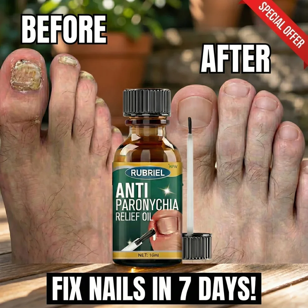 Anti Paronychia Relief Oil - (Buy_1_Get_1 _FREE)